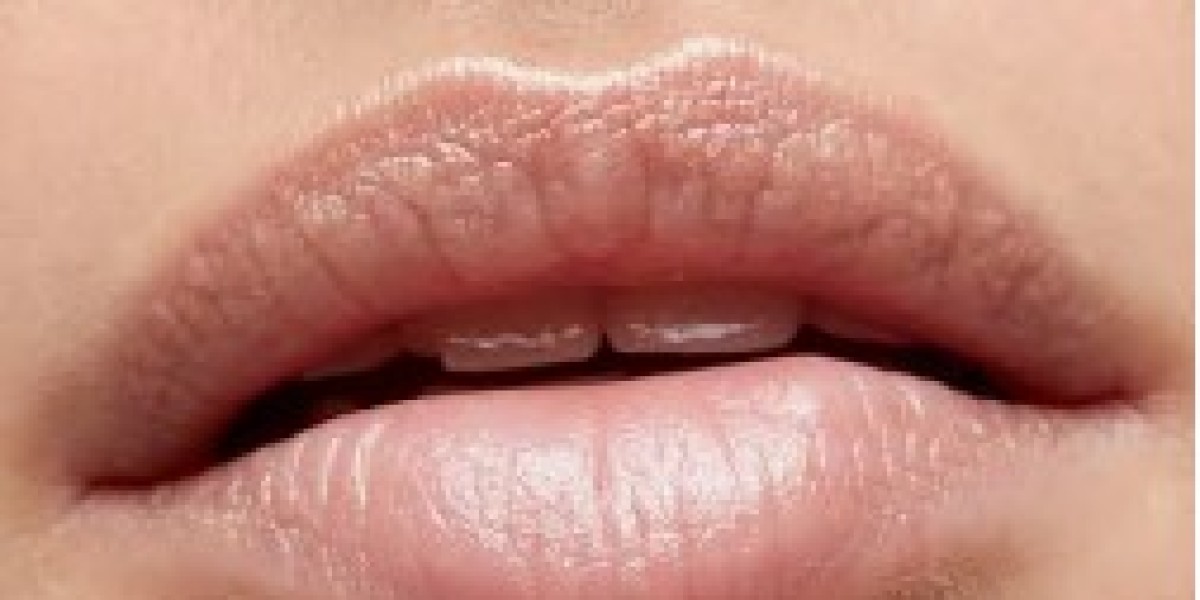 Natürliche Lippenfiller – Die Kunst, Schönheit nicht zu überzeichnen