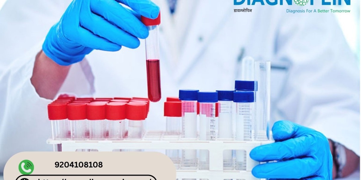 HbA1C Test in Pune | Accurate Diabetes Blood Test & Reports