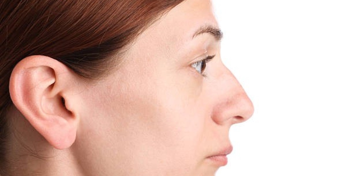 Is Hiko Nose Lift in Riyadh Affordable?