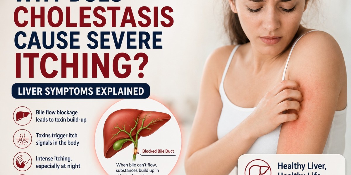 Why Does Cholestasis Cause Severe Itching? Liver Symptoms Explained