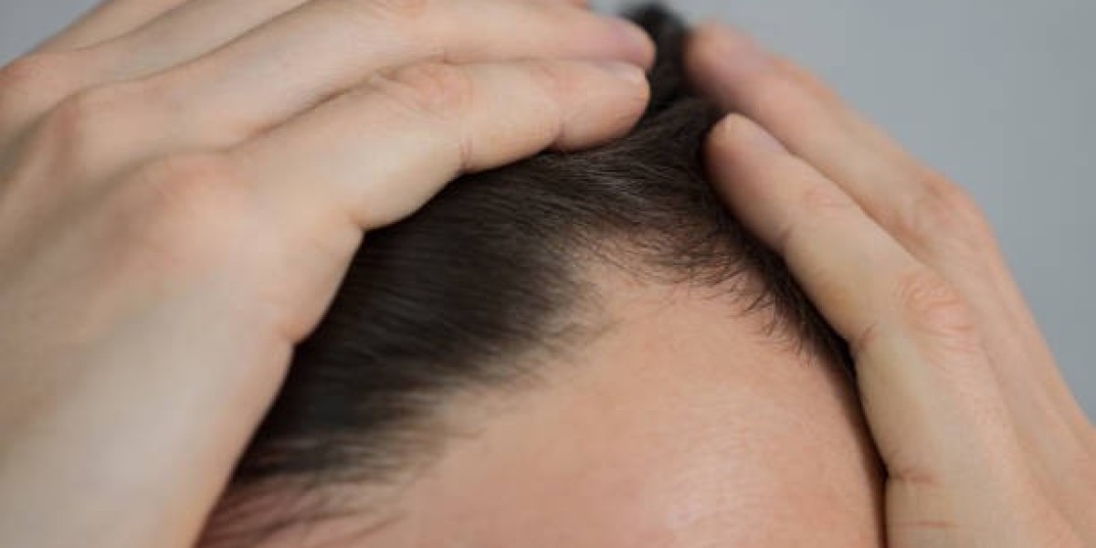 How to Choose the Right Clinic for PRP Hair Treatment