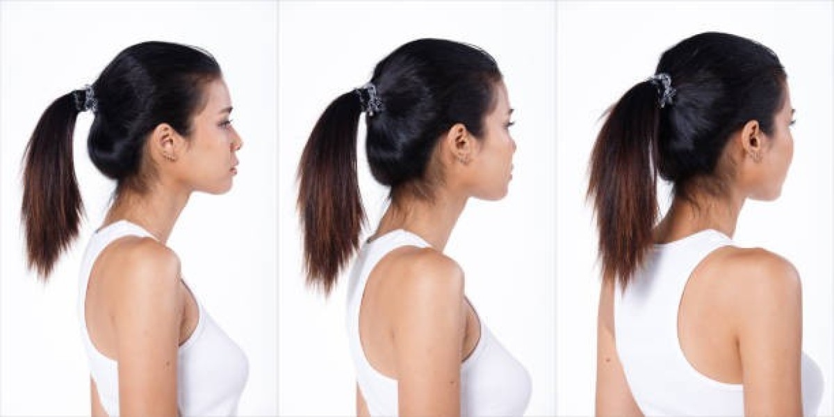 Surgical Techniques for Buffalo Hump Removal in Riyadh