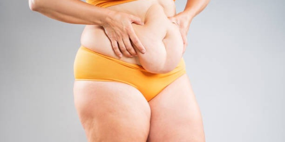When Can You Sleep Normally After Tummy Tuck Surgery?