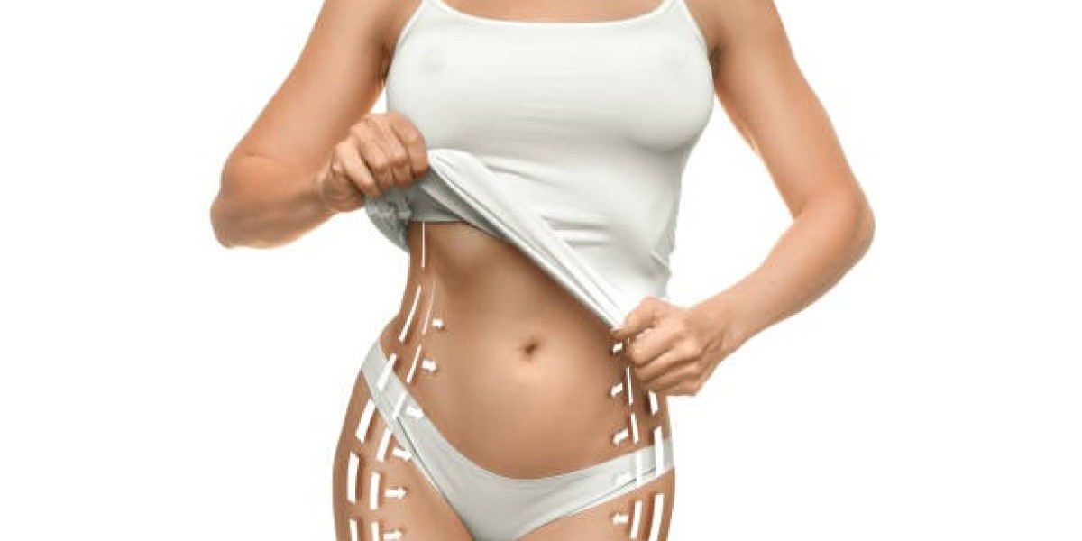 How Long Do Liposuction Results Last?