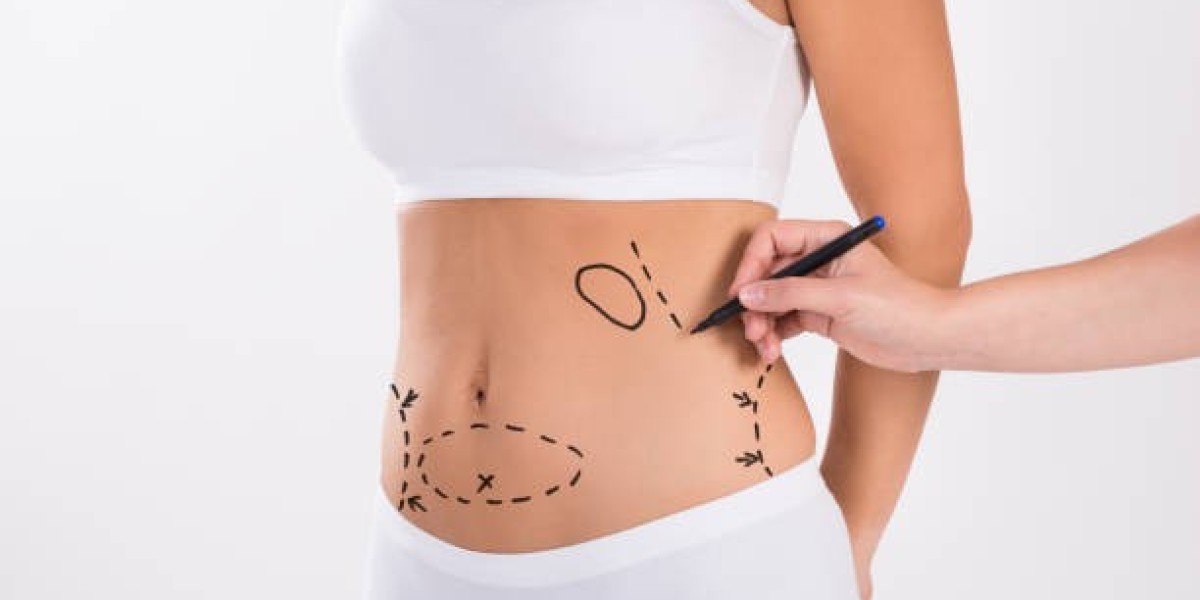 What Should You Avoid After Fat Melting Injections?