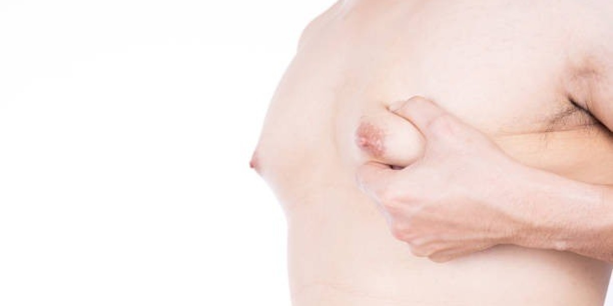 Fast Recovery Gynecomastia Surgery in Riyadh