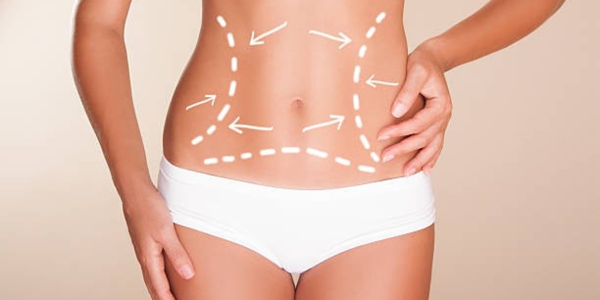 Liposuction Aftercare Practices for Supporting the Healing Process