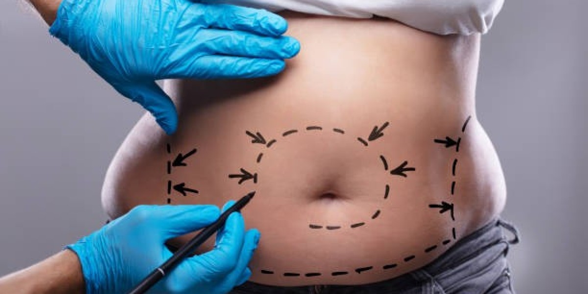 Fat Melting Injections for Belly Fat