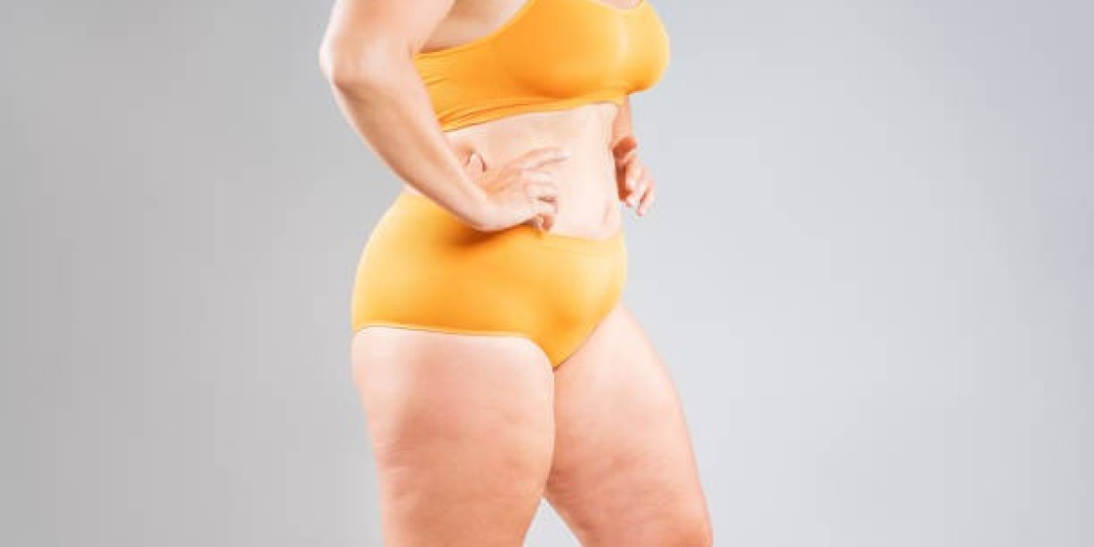 Tummy Tuck Surgery After Pregnancy and Breastfeeding