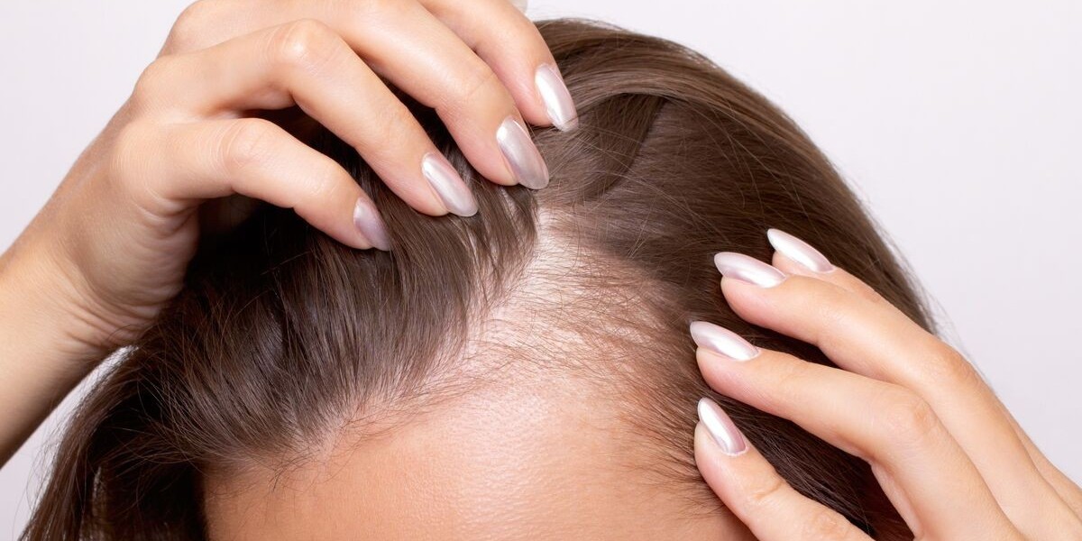 Struggling with Hair Fall? Know Your Options Before It Gets Worse