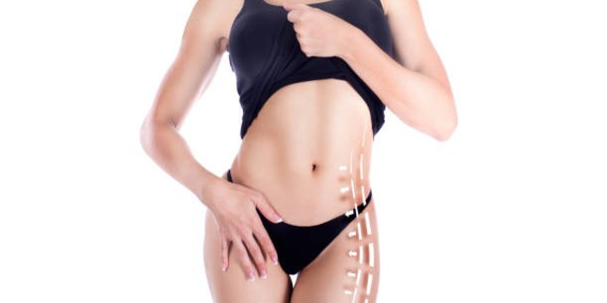 Liposuction Before and After: What to Expect