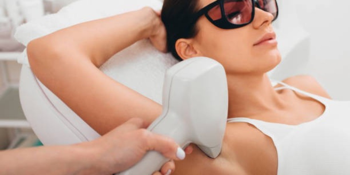 Is Laser Hair Removal Permanent?