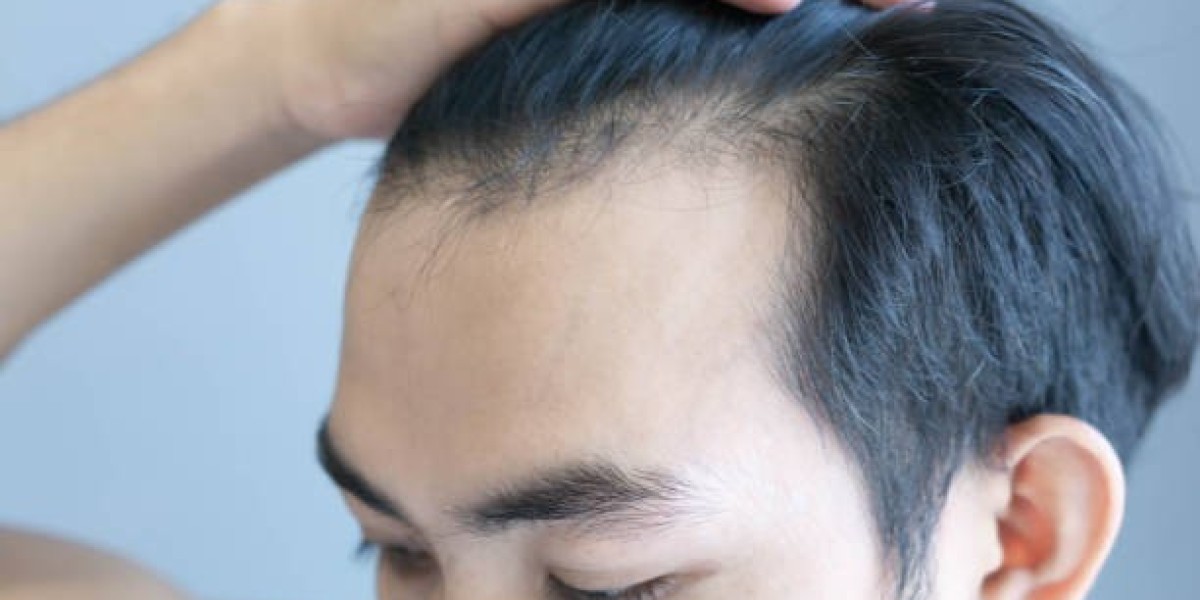 PRP Hair Treatment Aftercare: What You Should Know