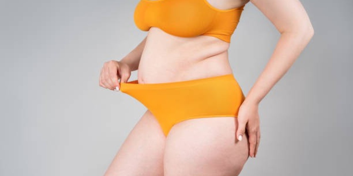 What Makes Tummy Tuck Surgery Different for Every Patient?