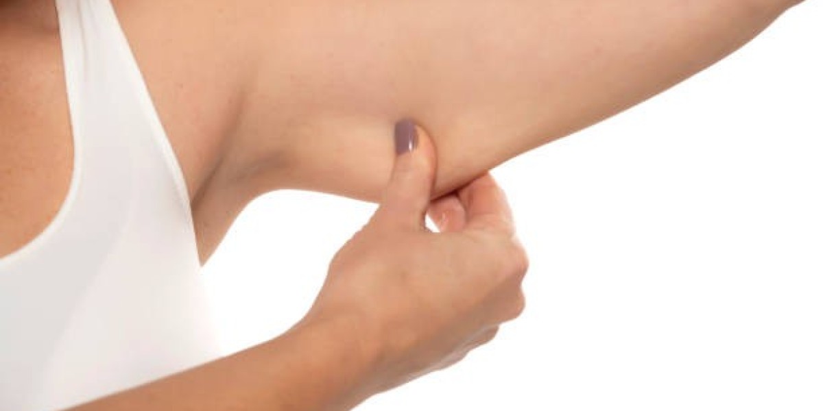 Arm Lift Surgery for Men: What Should You Know?