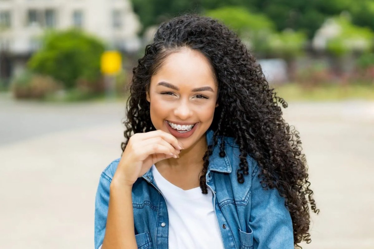 What Types of Braces Are Available in Hayward? A Clear Guide to Choosing the Right Option for Your Smile – cvorthodontics1