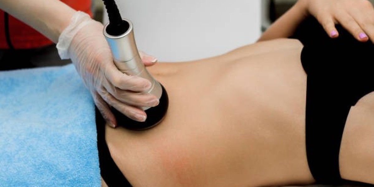 What Are the Possible Side Effects of Venus Legacy?
