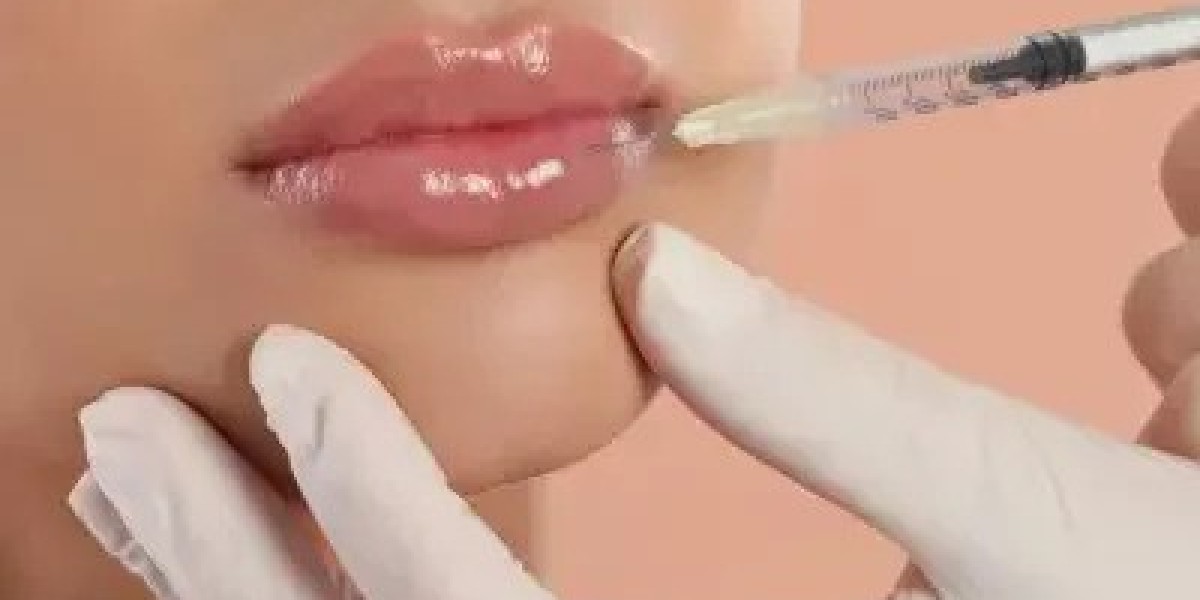Fillers Injection in Dubai - Cannula vs Needle Considerations for Safer Placement